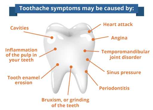 Intermittent tooth pain - causes and when to worry