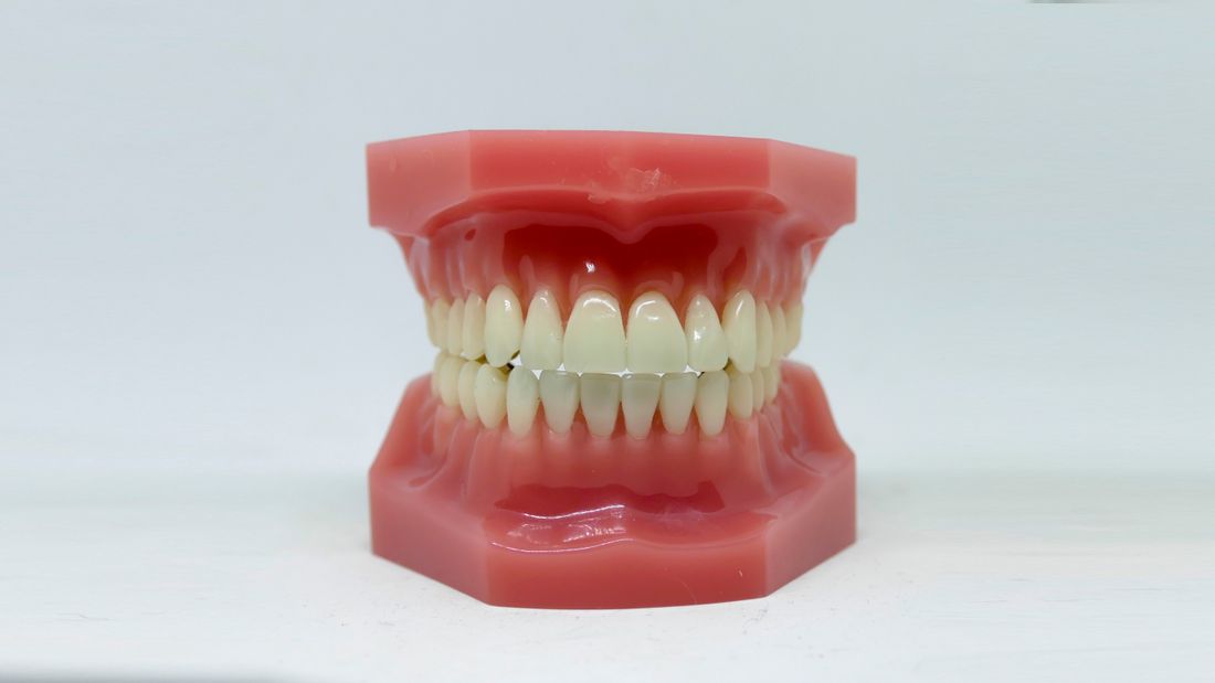 A dental model showing a full set of upper and lower teeth