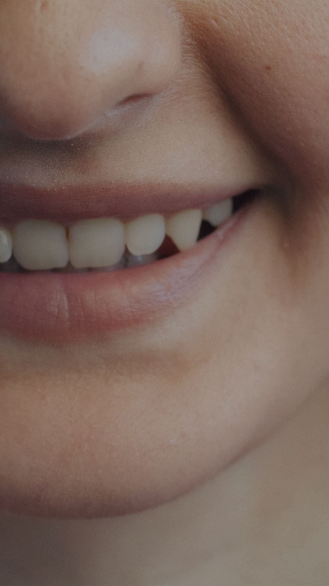 Close-up of a smiling mouth showing the upper front teeth