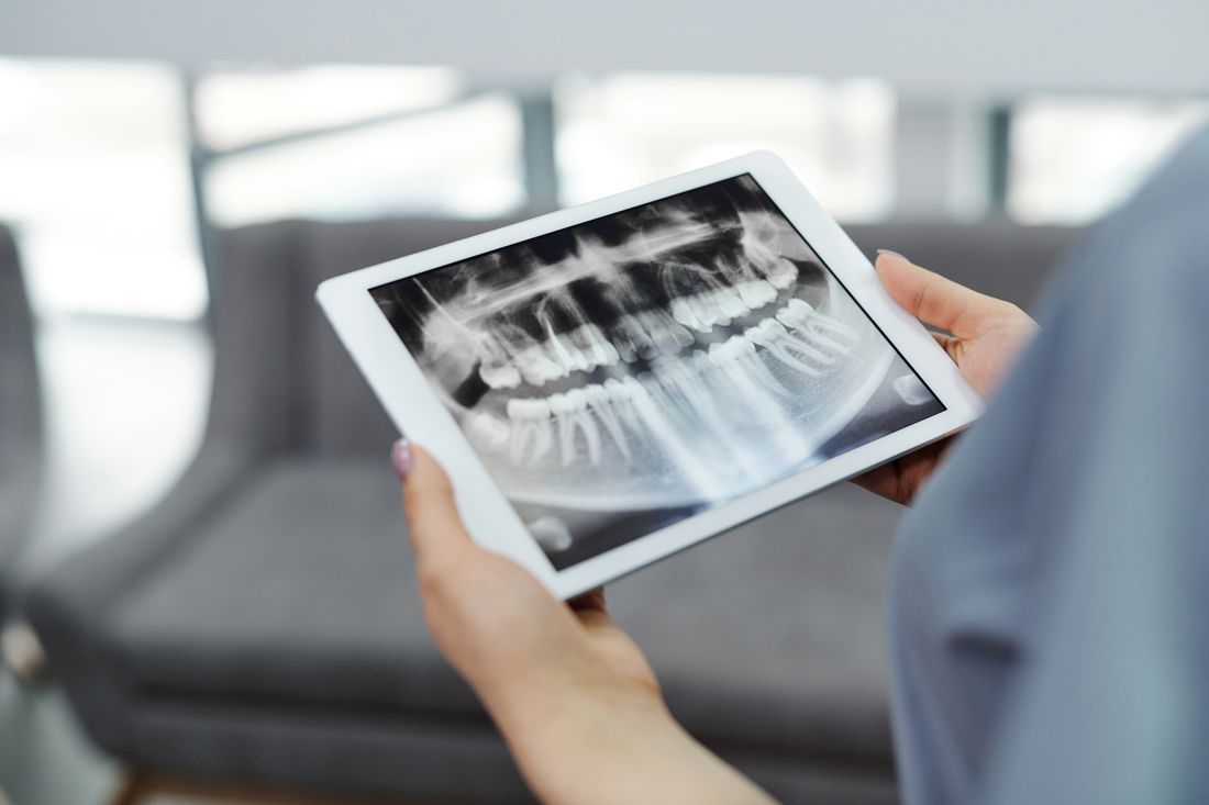 Dentist screen showing a set of dental X-rays next to a printed treatment plan, ready to be uploaded for an online second opinion