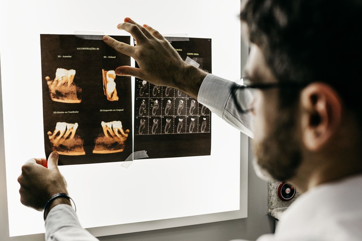 A dentist examining dental X-ray images on screen