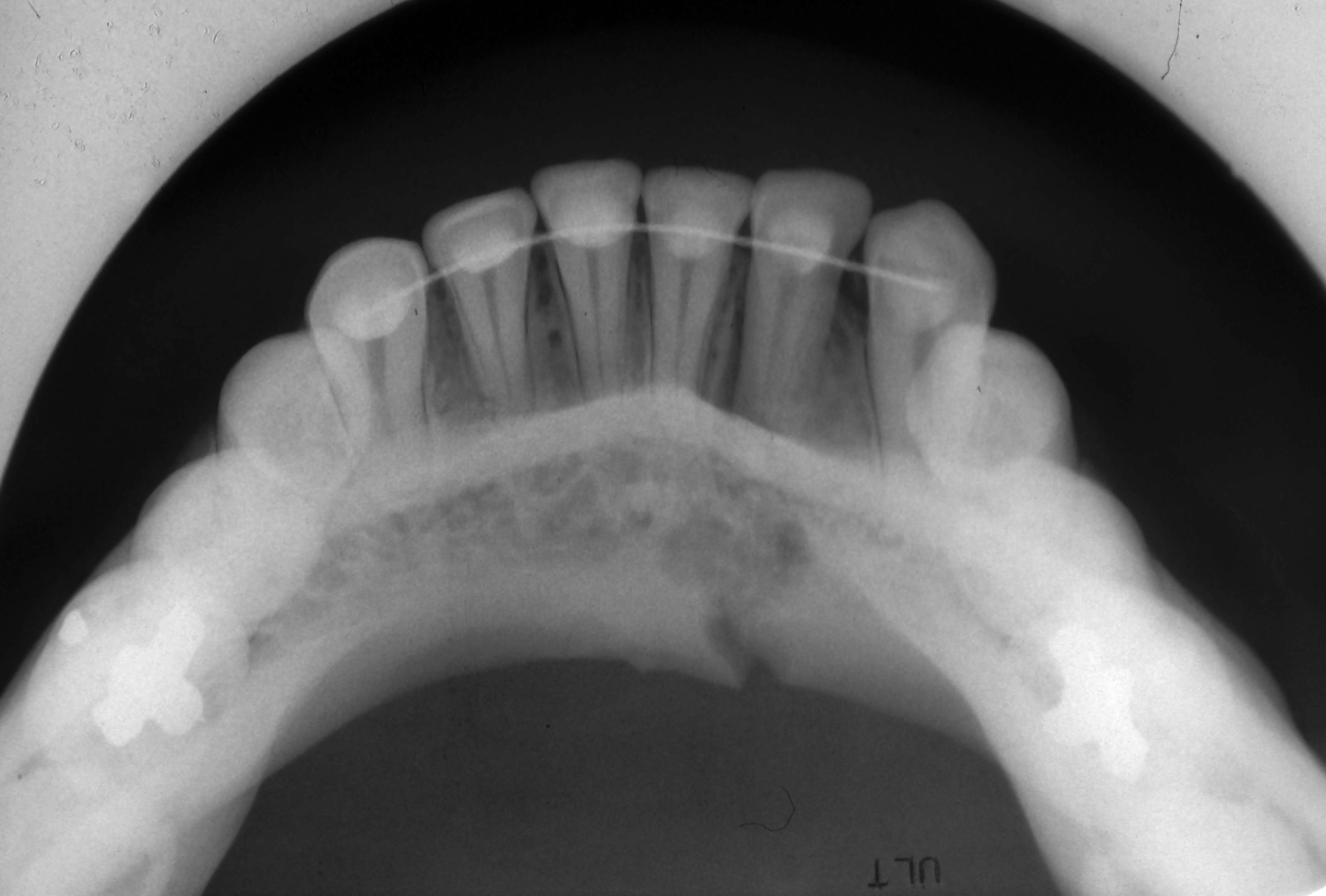 Occlusal dental X-ray showing a broad view of the lower jaw