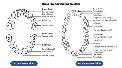 Universal Numbering System chart for permanent and primary teeth